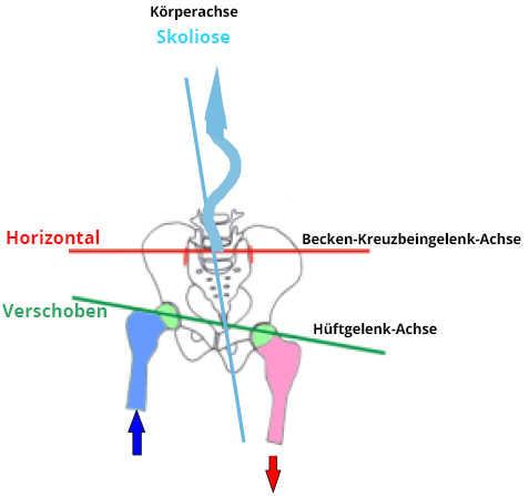 Schwingkissen Probleme